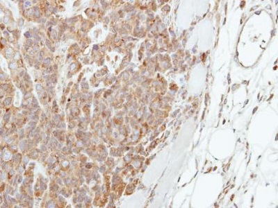 Immunohistochemistry (Formalin/PFA-fixed paraffin-embedded sections) - Anti-Involucrin antibody - N-terminal (AB227530)