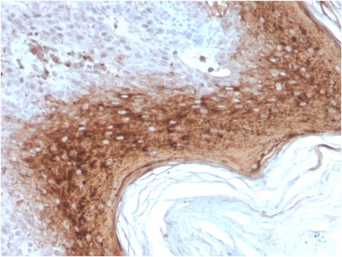Immunohistochemistry (Formalin/PFA-fixed paraffin-embedded sections) - Anti-Involucrin antibody [rIVRN/827] (AB270720)