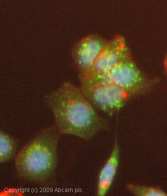 Immunocytochemistry/ Immunofluorescence - Anti-Involucrin antibody [SY5] (AB68), expandable thumbnail