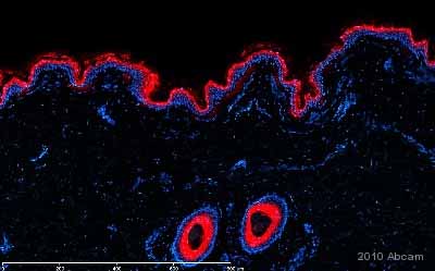 Immunohistochemistry (Formalin/PFA-fixed paraffin-embedded sections) - Anti-Involucrin antibody [SY5] (AB68), expandable thumbnail