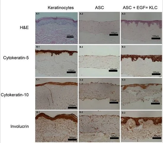 Immunohistochemistry (Formalin/PFA-fixed paraffin-embedded sections) - Anti-Involucrin antibody [SY5] (AB68)