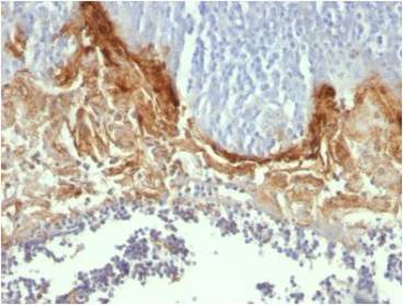 Immunohistochemistry (Formalin/PFA-fixed paraffin-embedded sections) - Anti-Involucrin antibody [SY5] (AB68), expandable thumbnail