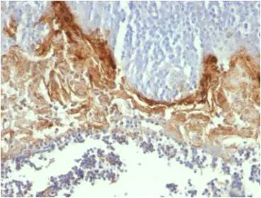 Immunohistochemistry (Formalin/PFA-fixed paraffin-embedded sections) - Anti-Involucrin antibody [SY5] (AB68)