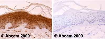 Immunohistochemistry (Formalin/PFA-fixed paraffin-embedded sections) - Anti-Involucrin antibody [SY8] (AB20202)