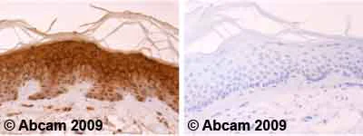 Immunohistochemistry (Formalin/PFA-fixed paraffin-embedded sections) - Anti-Involucrin antibody [SY8] (AB20202)