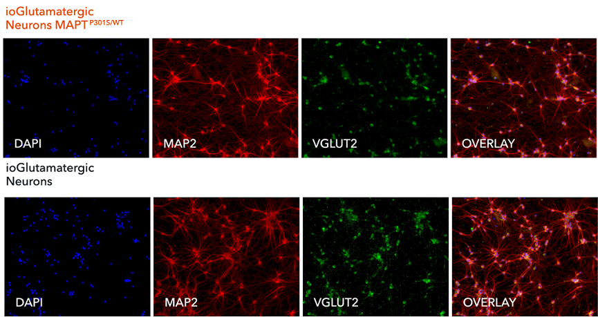 Immunocytochemistry/ Immunofluorescence - ioGlutamatergic Neurons MAPT P301S heterozygous - Human iPSC derived cells (AB307784), expandable thumbnail