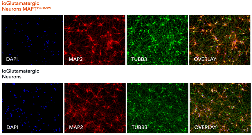 Immunocytochemistry/ Immunofluorescence - ioGlutamatergic Neurons MAPT P301S heterozygous - Human iPSC derived cells (AB307784), expandable thumbnail