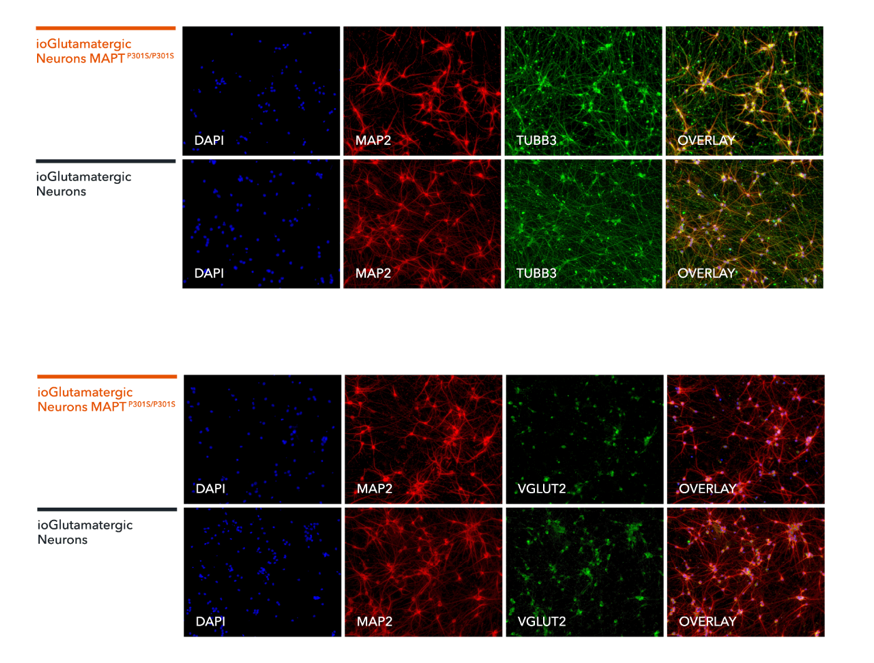 Immunocytochemistry/ Immunofluorescence - ioGlutamatergic Neurons MAPT P301S homozygous - Human iPSC derived cells (AB307783), expandable thumbnail