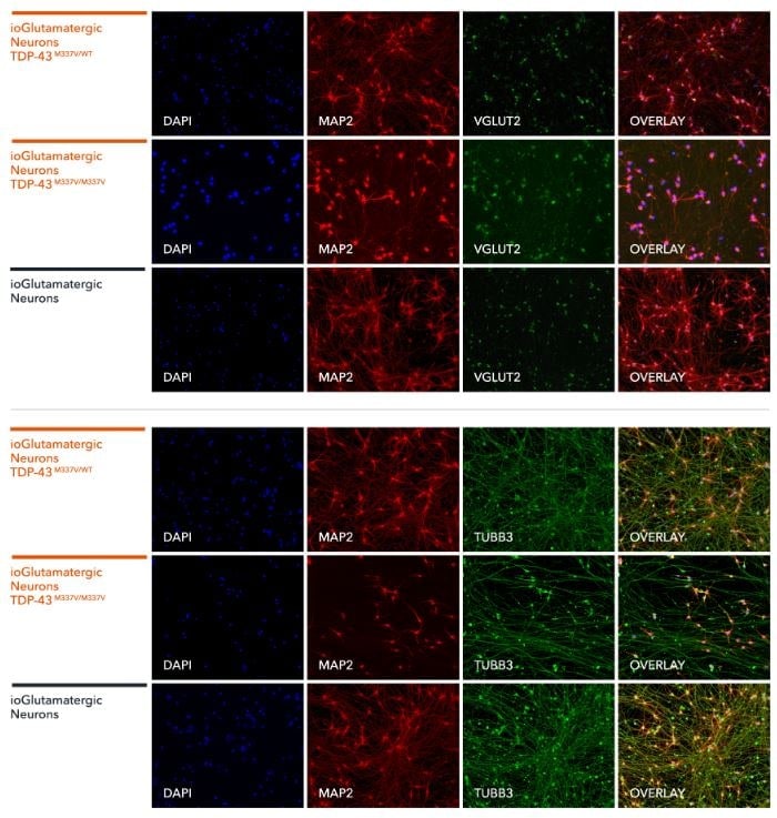Immunocytochemistry/ Immunofluorescence - ioGlutamatergic Neurons TDP-43 M337V heterozygous - Human iPSC derived cells (AB307782), expandable thumbnail