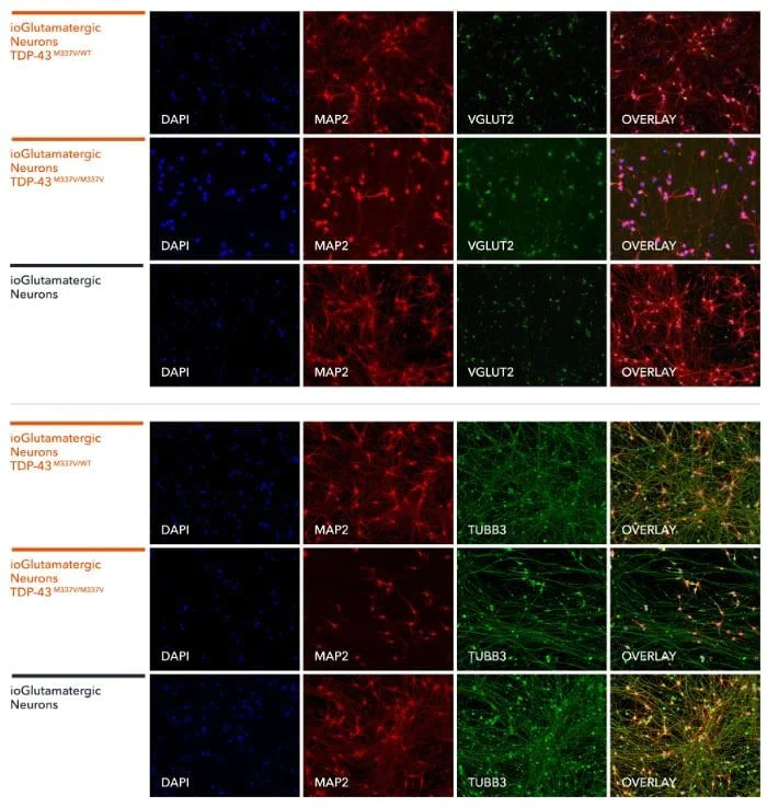 Immunocytochemistry/ Immunofluorescence - ioGlutamatergic Neurons TDP-43 M337V heterozygous - Human iPSC derived cells (AB307782)