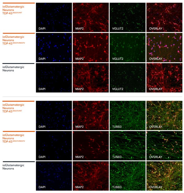 Immunocytochemistry/ Immunofluorescence - ioGlutamatergic Neurons TDP-43 M337V homozygous - Human iPSC derived cells (AB307781), expandable thumbnail
