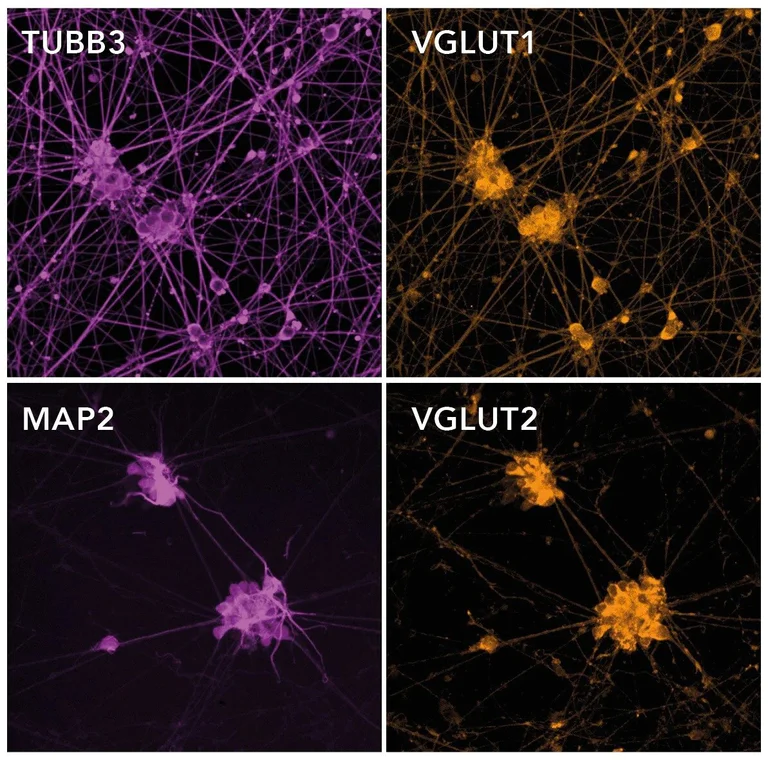 Immunocytochemistry/ Immunofluorescence - ioGlutamatergic Neurons WT (isogenic control) - Human iPSC derived cells (AB303447)