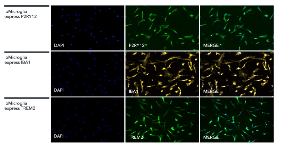 Immunocytochemistry/ Immunofluorescence - ioMicroglia™ - Human iPSC derived cells (AB317488), expandable thumbnail