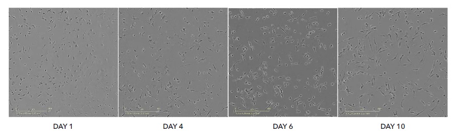 Light Microscopy - ioMicroglia™ - Human iPSC derived cells (AB317488), expandable thumbnail
