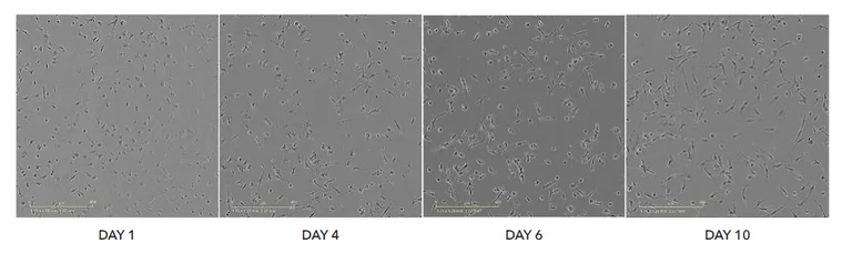Light Microscopy - ioMicroglia™ - Human iPSC derived cells (AB317488)
