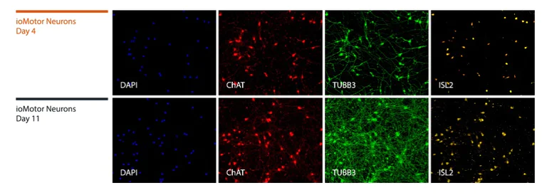 Immunocytochemistry/ Immunofluorescence - ioMotor Neurons™ - Human iPSC derived cells (AB317486)