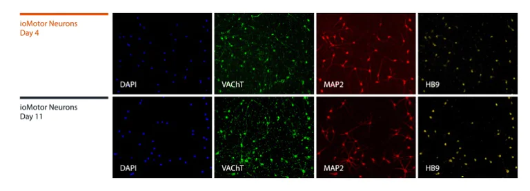 Immunocytochemistry/ Immunofluorescence - ioMotor Neurons™ - Human iPSC derived cells (AB317486)