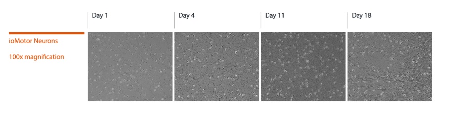 Light Microscopy - ioMotor Neurons™ - Human iPSC derived cells (AB317486), expandable thumbnail