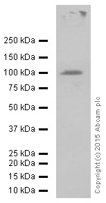 Western blot - Anti-Ionotropic glutamate receptor 2 + 3 antibody [EP929Y] (AB52896), expandable thumbnail