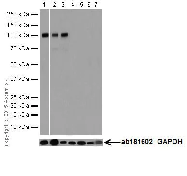 Western blot - Anti-Ionotropic Glutamate receptor 2 + 3 antibody [EPR18115] (AB206293)