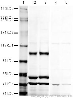 Western blot - Anti-Ionotropic Glutamate receptor 2 antibody (AB20673), expandable thumbnail