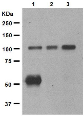 Western blot - Anti-Ionotropic Glutamate receptor 2 antibody [EP966Y] (AB52932)