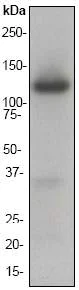 Western blot - Anti-Ionotropic Glutamate receptor 2 antibody [EP966Y] (AB52932)