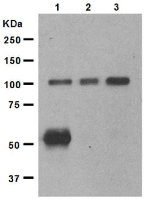 Western blot - Anti-Ionotropic Glutamate receptor 2 antibody [EP966Y] - BSA and Azide free (AB246356)