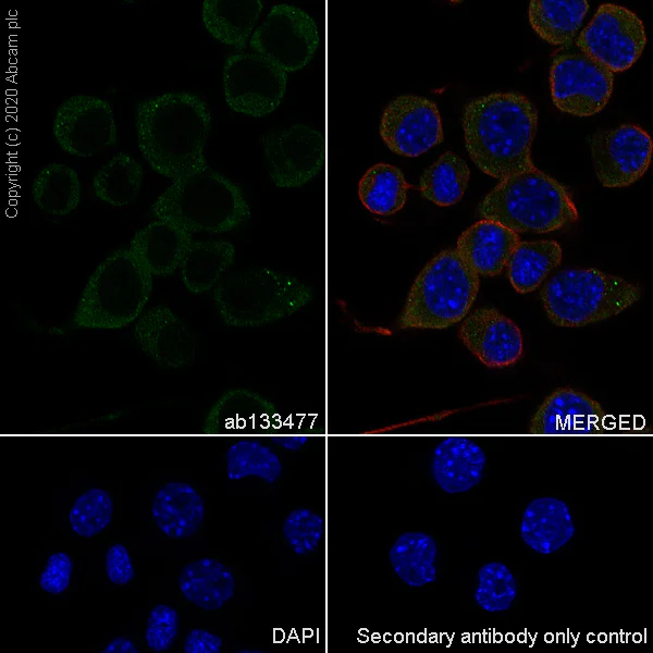 Immunocytochemistry/ Immunofluorescence - Anti-Ionotropic Glutamate receptor 2 antibody [EPR5032] (AB133477)