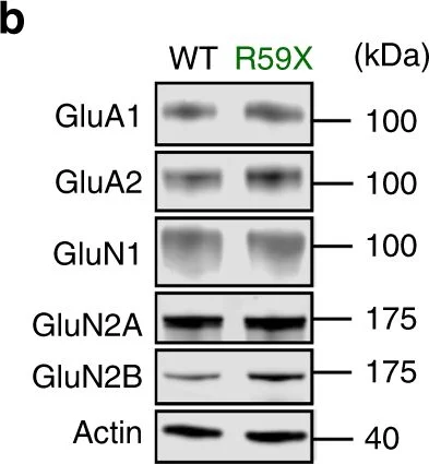 Western blot - Anti-Ionotropic Glutamate receptor 2 antibody [EPR5032] (AB133477)