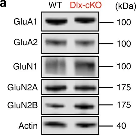 Western blot - Anti-Ionotropic Glutamate receptor 2 antibody [EPR5032] (AB133477)