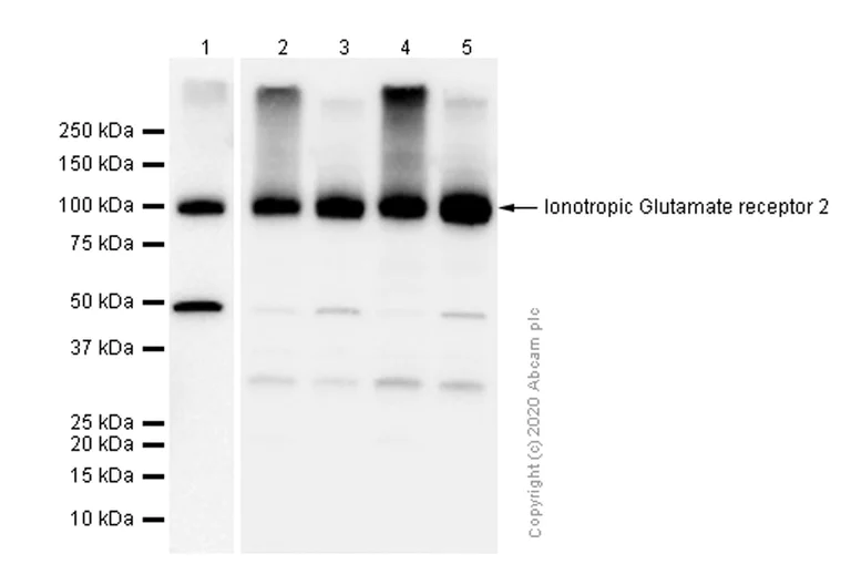 Western blot - Anti-Ionotropic Glutamate receptor 2 antibody [EPR5032] - BSA and Azide free (AB240061)