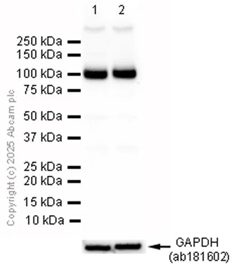 Western blot - Anti-Ionotropic Glutamate receptor 2 antibody [EPR5032] - BSA and Azide free (AB240061)