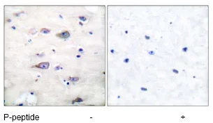 Immunohistochemistry (Formalin/PFA-fixed paraffin-embedded sections) - Anti-Ionotropic Glutamate receptor 2 (phospho S880) antibody (AB52180)