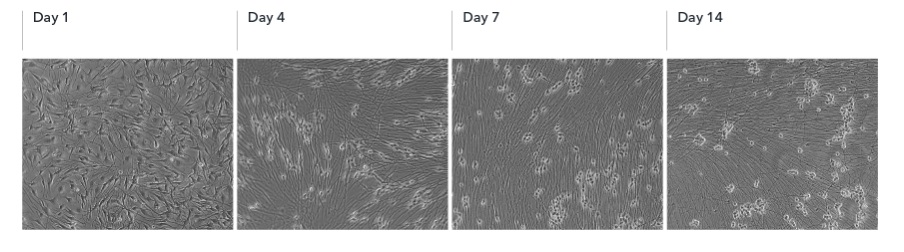 Light Microscopy - ioSensory Neurons™ - Human iPSC derived cells (AB317489), expandable thumbnail