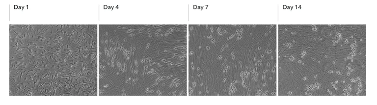 Light Microscopy - ioSensory Neurons™ - Human iPSC derived cells (AB317489)