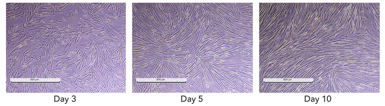 Cell Culture - ioSkeletal Myocytes - Human iPSC derived cells (AB277612)