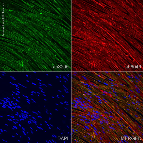 Immunocytochemistry - ioSkeletal Myocytes - Human iPSC derived cells (AB277612)