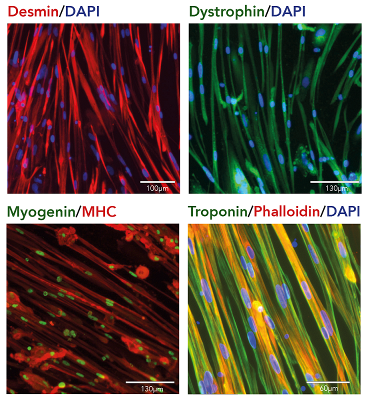 Immunocytochemistry - ioSkeletal Myocytes - Human iPSC derived cells (AB277612), expandable thumbnail