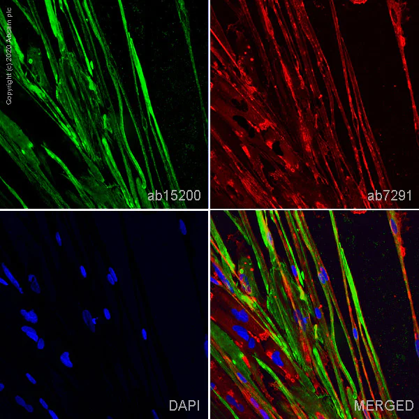 Immunocytochemistry/ Immunofluorescence - ioSkeletal Myocytes - Human iPSC derived cells (AB277612)