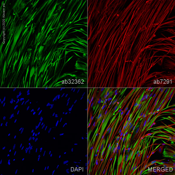 Immunocytochemistry/ Immunofluorescence - ioSkeletal Myocytes - Human iPSC derived cells (ab277612), expandable thumbnail