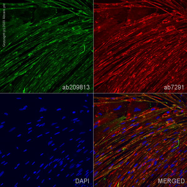Immunocytochemistry/ Immunofluorescence - ioSkeletal Myocytes - Human iPSC derived cells (ab277612), expandable thumbnail
