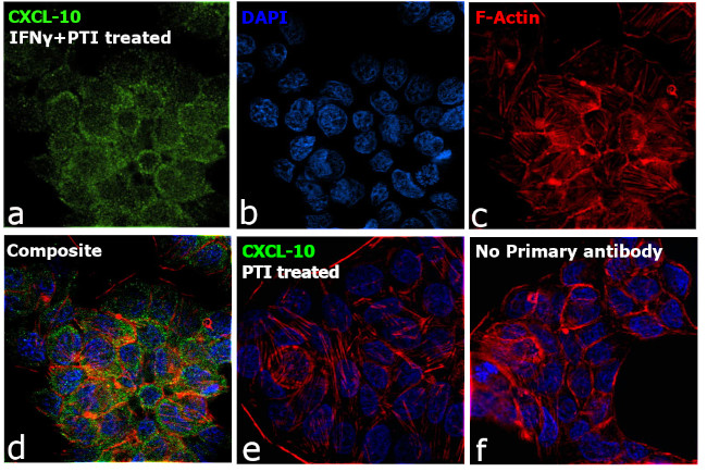 Immunocytochemistry/ Immunofluorescence - Anti-IP-10 antibody [RP23040081] (AB307997), expandable thumbnail