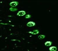 Immunocytochemistry/ Immunofluorescence - Anti-IP3 receptor antibody (AB5804)