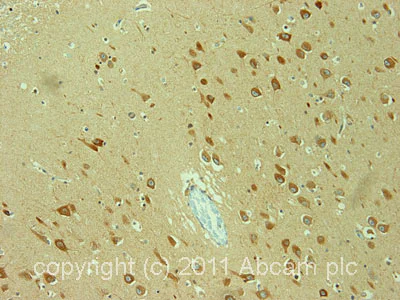 Immunohistochemistry (Formalin/PFA-fixed paraffin-embedded sections) - Anti-IP3 receptor antibody (AB5804)