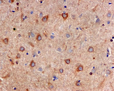 Immunohistochemistry (Formalin/PFA-fixed paraffin-embedded sections) - Anti-IP3 receptor antibody [EPR4536] (AB125076)