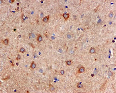 Immunohistochemistry (Formalin/PFA-fixed paraffin-embedded sections) - Anti-IP3 receptor antibody [EPR4536] - BSA and Azide free (AB248112)