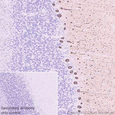 Immunohistochemistry (Formalin/PFA-fixed paraffin-embedded sections) - Anti-IP3 receptor antibody [EPR4537] (AB108517)