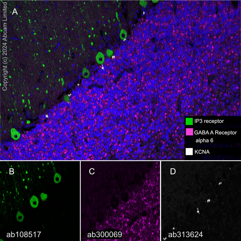Multiplex immunohistochemistry - Anti-IP3 receptor antibody [EPR4537] (AB108517)