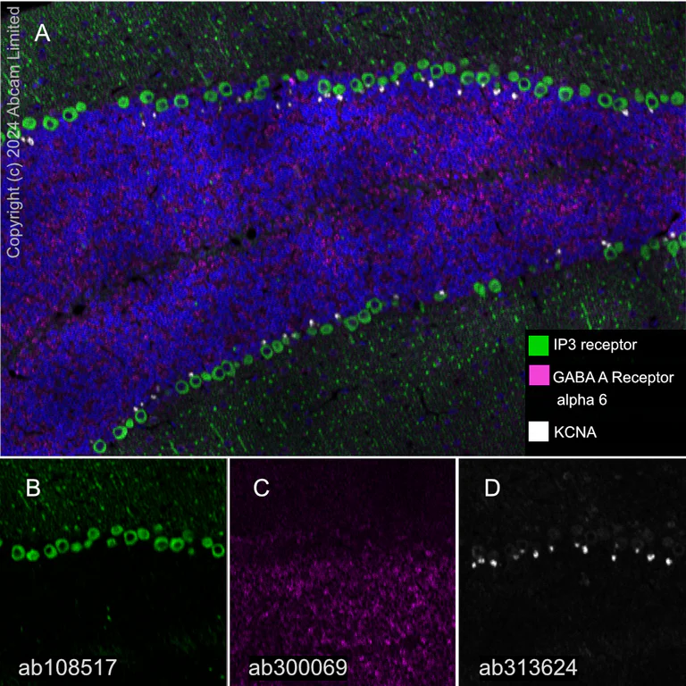 Multiplex immunohistochemistry - Anti-IP3 receptor antibody [EPR4537] (AB108517)